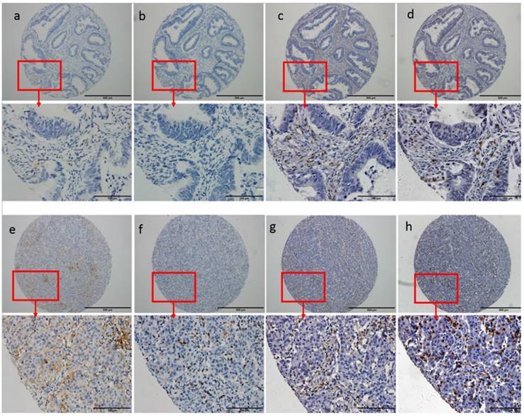 J Cancer Image