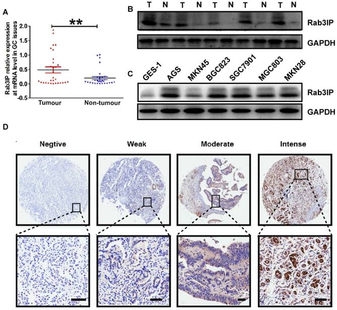 J Cancer Image