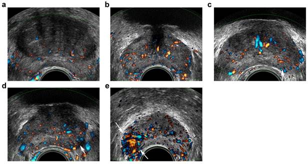 J Cancer Image