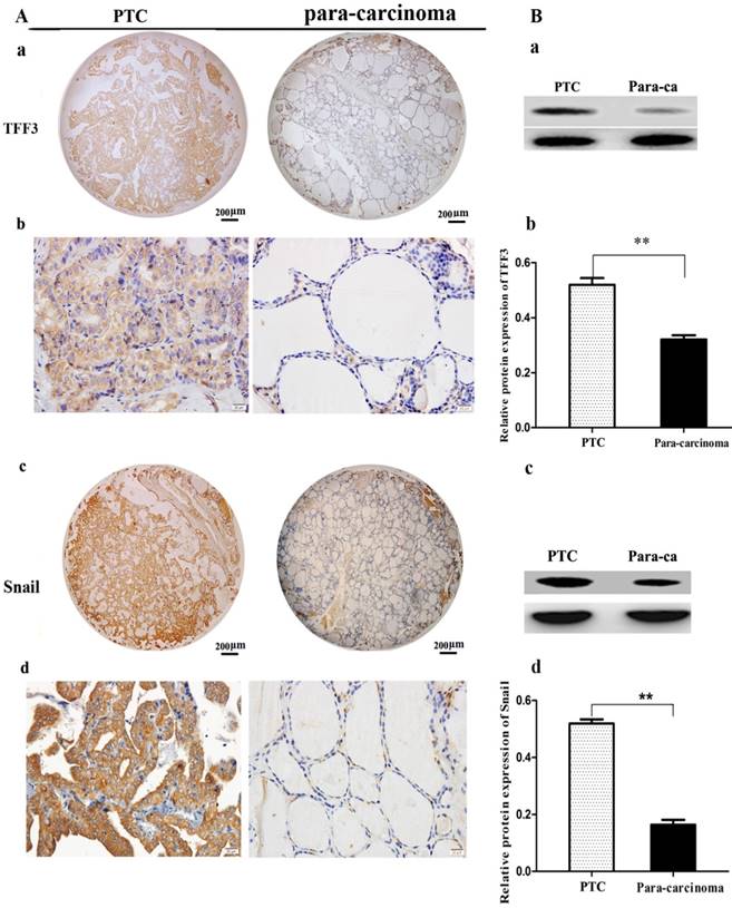 J Cancer Image