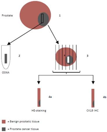 J Cancer Image