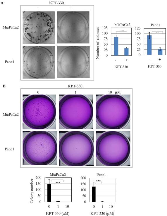 J Cancer Image