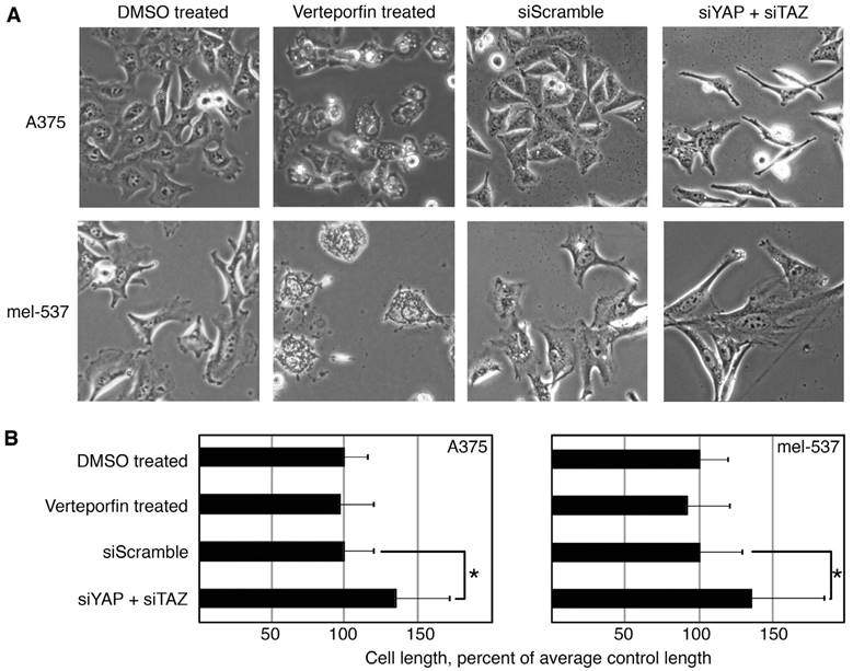 J Cancer Image