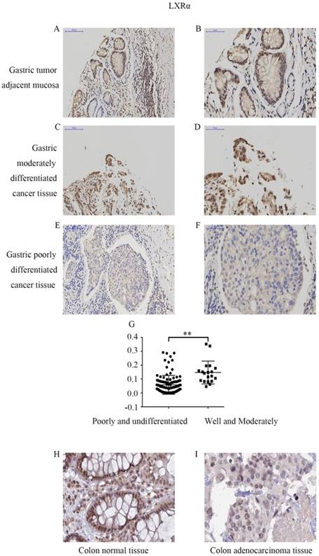 J Cancer Image