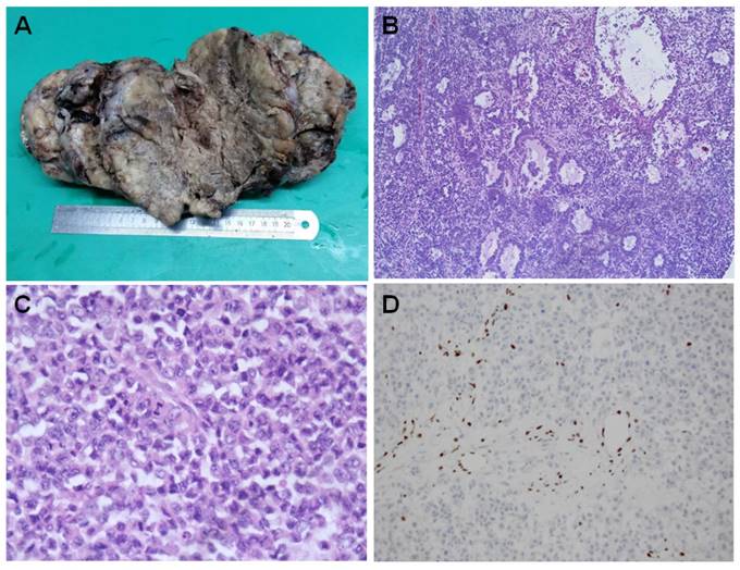 J Cancer Image