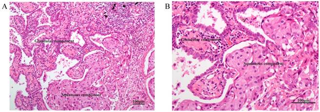 J Cancer Image