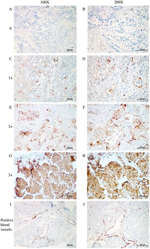 J Cancer Image