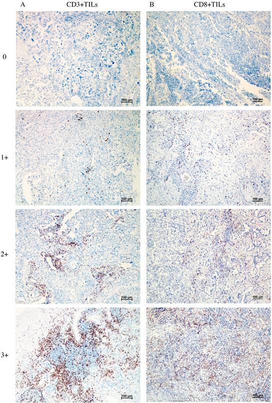 J Cancer Image