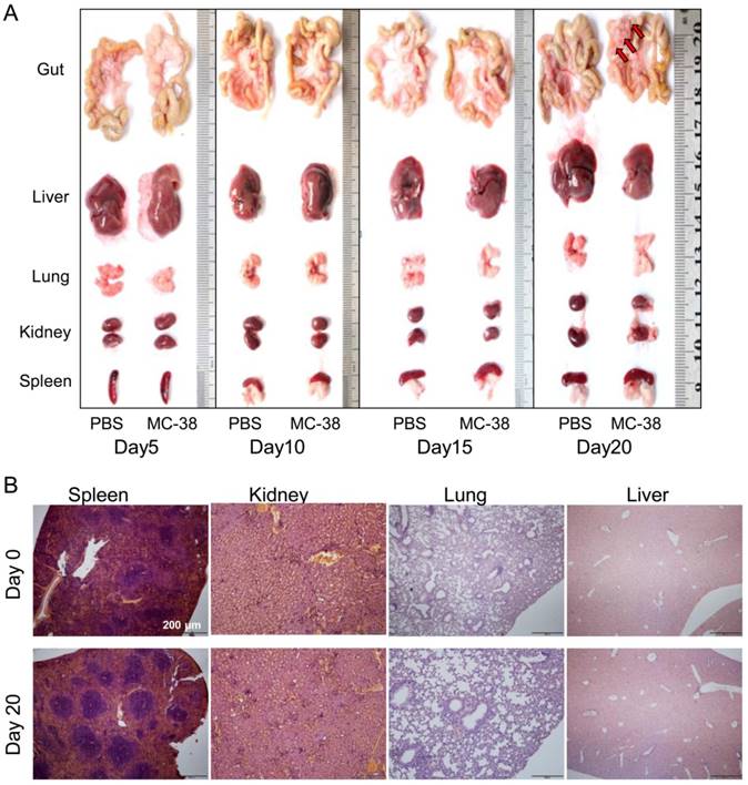 J Cancer Image