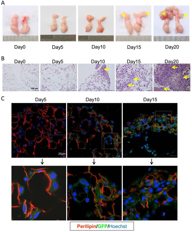 J Cancer Image