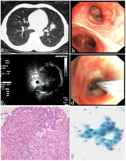 J Cancer Image