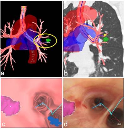 J Cancer Image