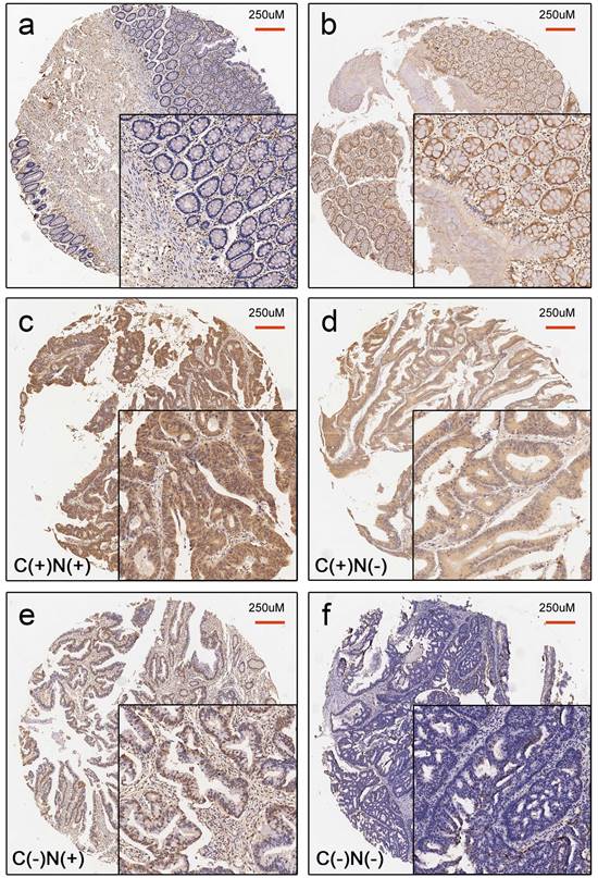 J Cancer Image