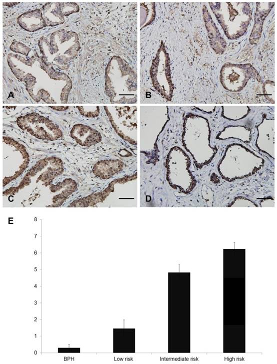 J Cancer Image