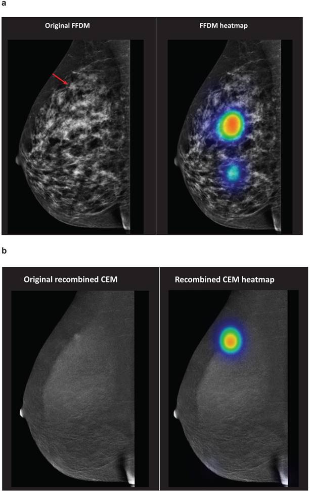 J Cancer Image