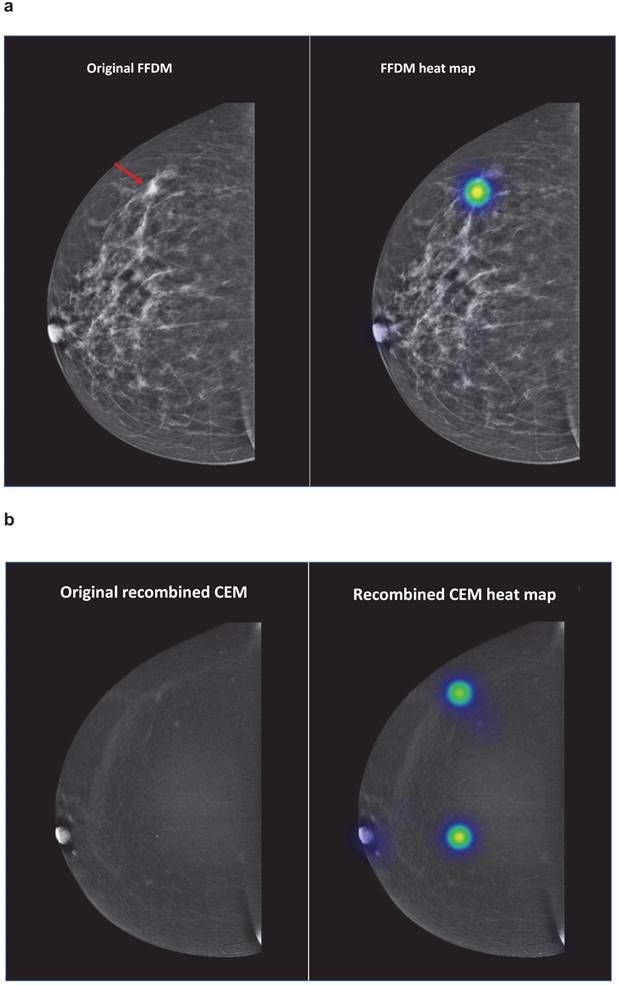 J Cancer Image