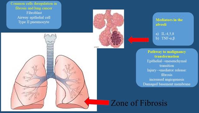 J Cancer Image