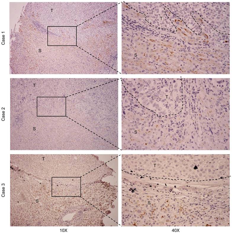 J Cancer Image