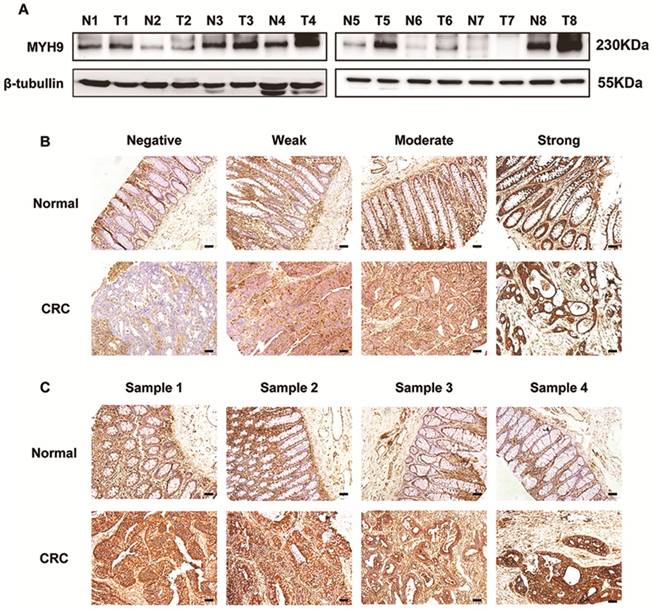 J Cancer Image