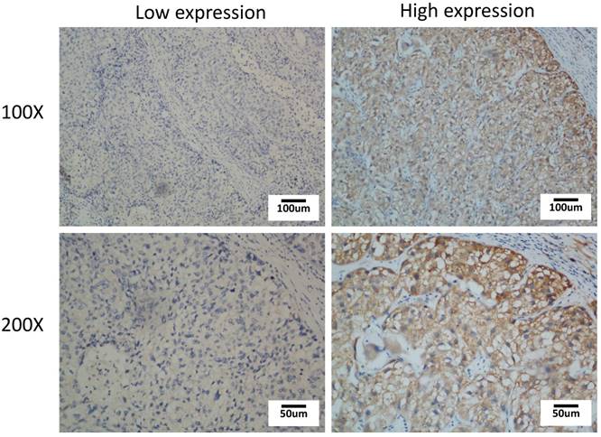 J Cancer Image