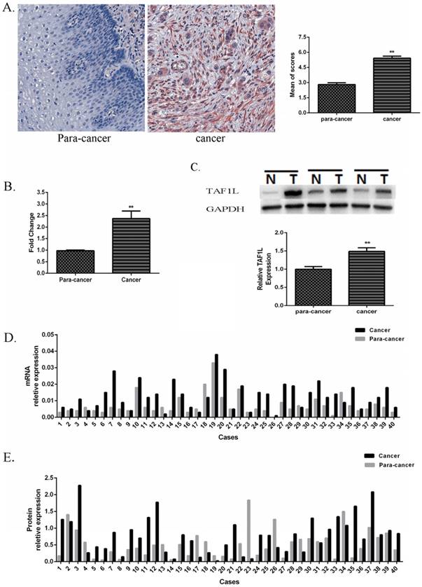 J Cancer Image