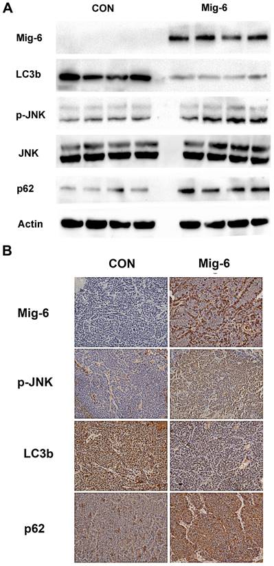 J Cancer Image