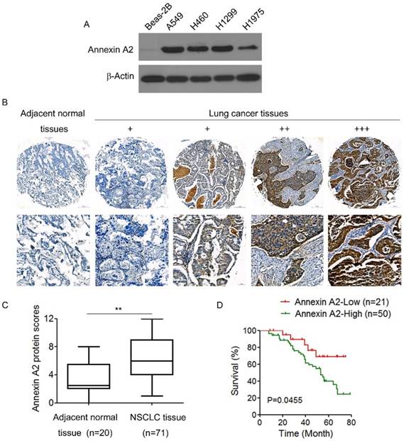 J Cancer Image