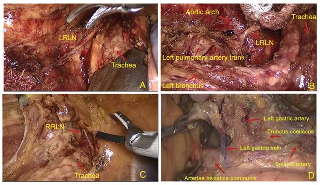 J Cancer Image