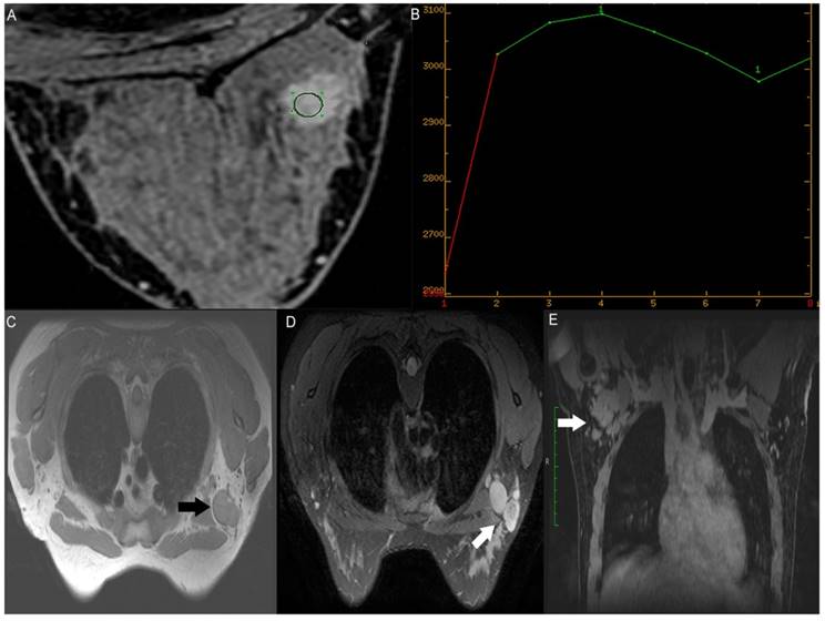 J Cancer Image