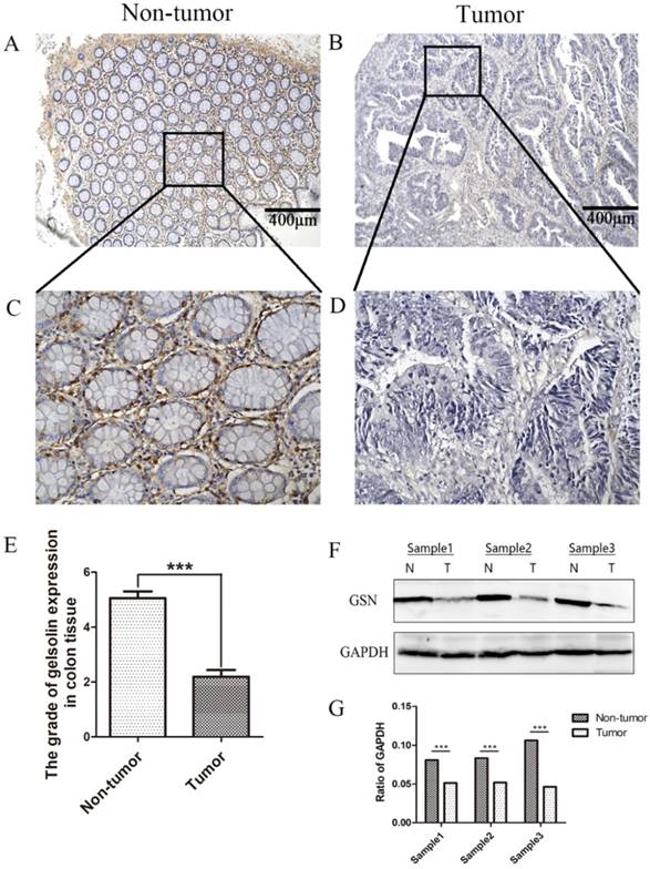 J Cancer Image