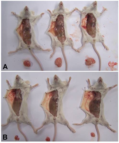 J Cancer Image