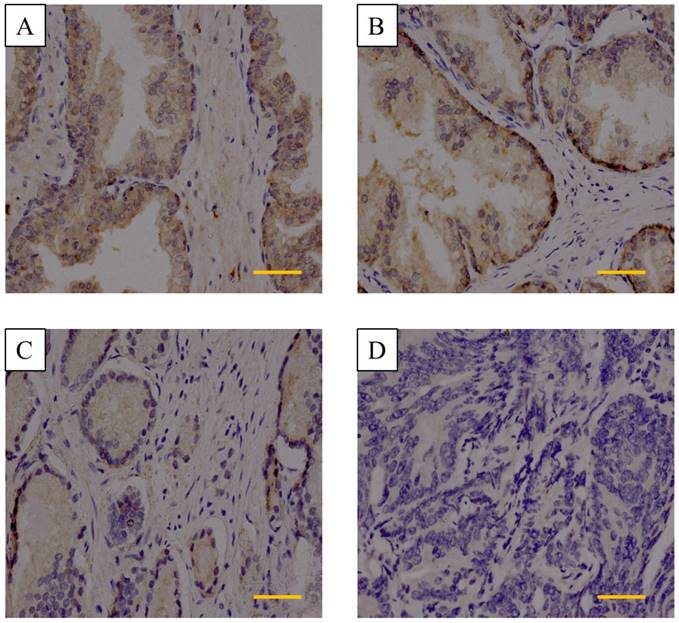 J Cancer Image