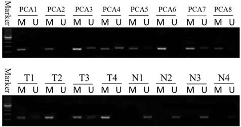 J Cancer Image