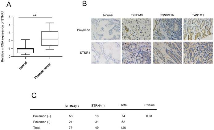 J Cancer Image