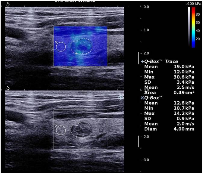 J Cancer Image