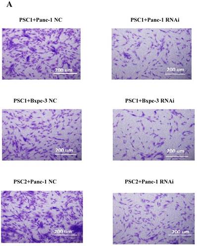 J Cancer Image