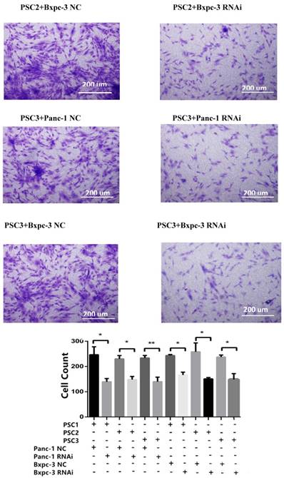 J Cancer Image