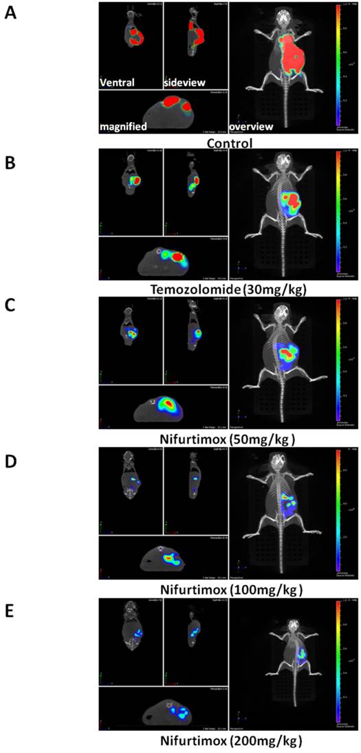 J Cancer Image