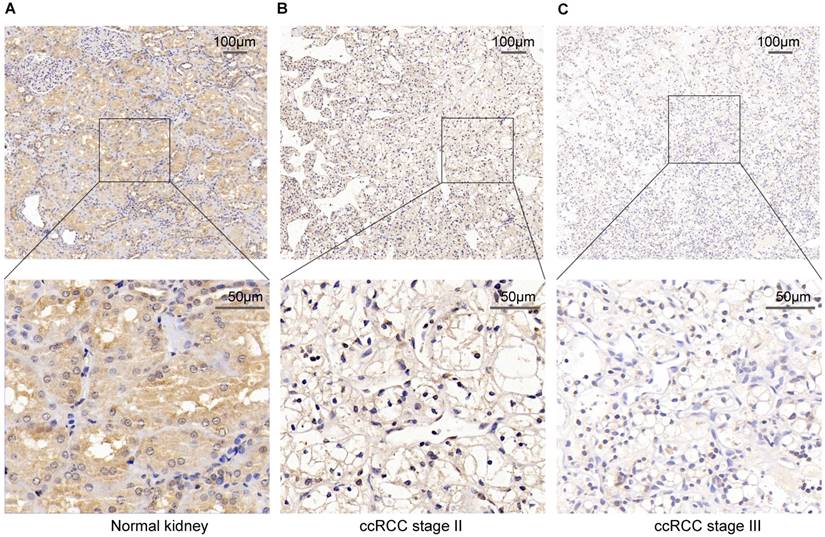 J Cancer Image