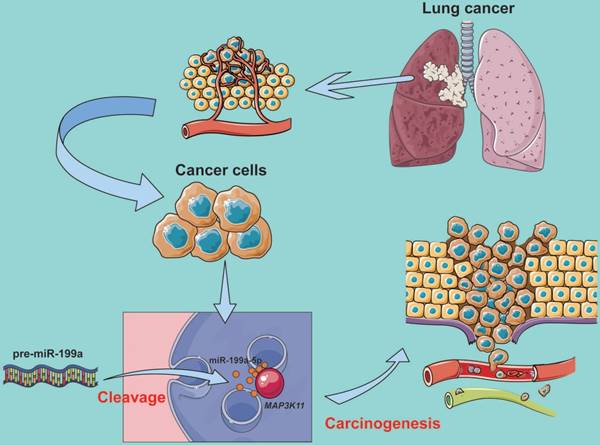 J Cancer Image