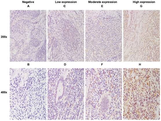 J Cancer Image