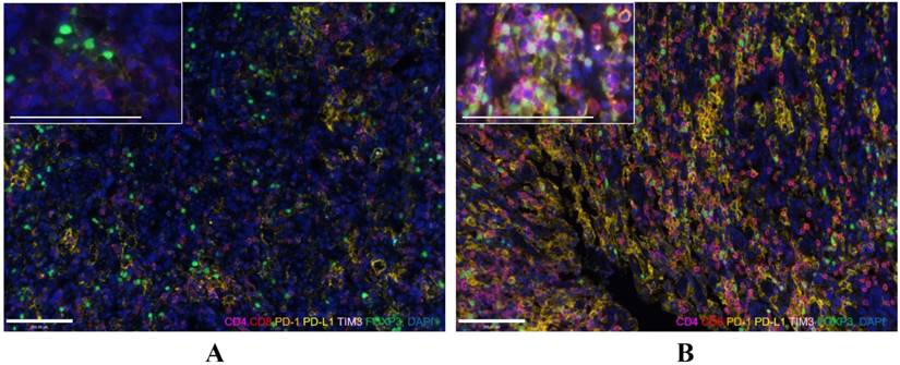 J Cancer Image