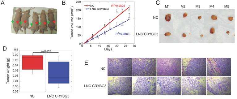 J Cancer Image