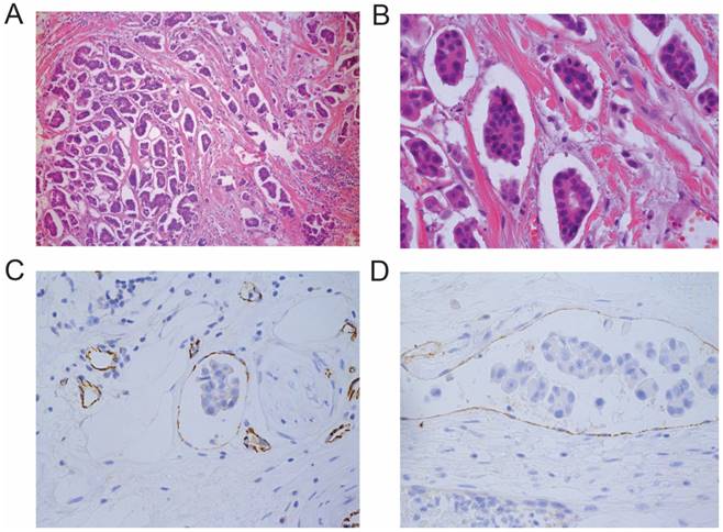 J Cancer Image