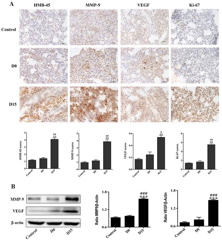 J Cancer Image