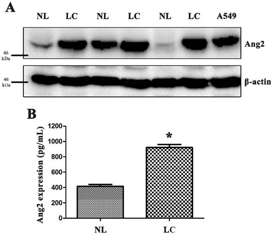 J Cancer Image