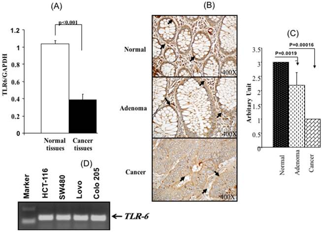 J Cancer Image