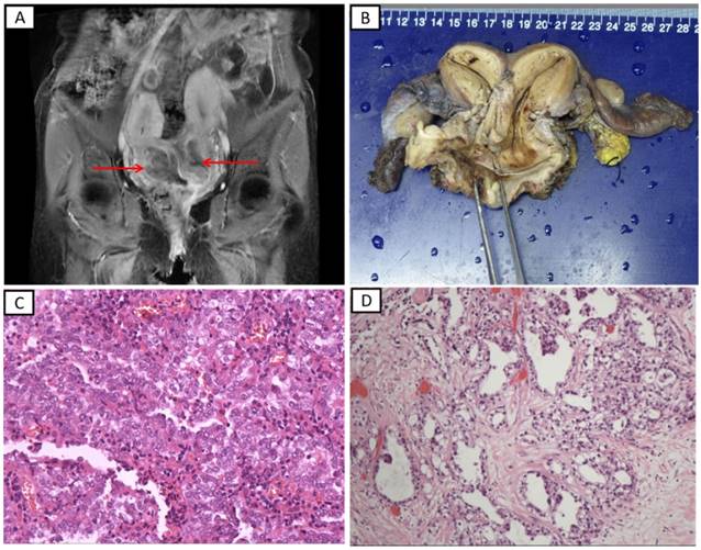 J Cancer Image