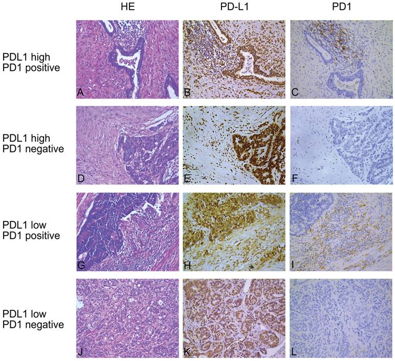 J Cancer Image