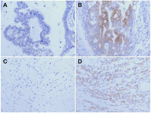 J Cancer Image